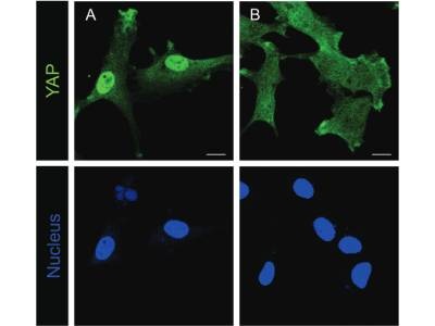 Researchers Identify Shuttle Protein with Key Role in Organ Growth