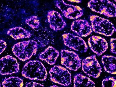 Researchers Develop New Fluorescent DNA Label for Clinical Superresolution Microscopy