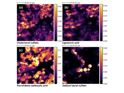 3D Mass Spec Provides Molecular Map of Upper Skin Layer