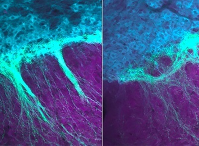 Developing Brain Needs Cannabinoid Receptors after Birth