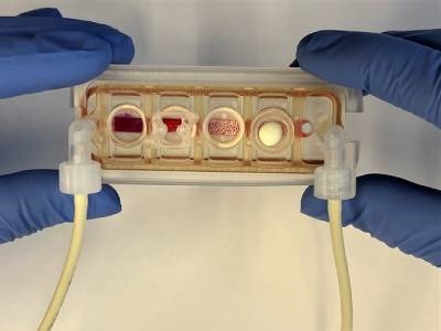 Multi-organ Chip Can Be Customized to Patient