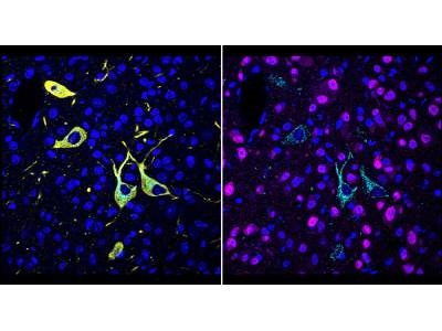 New Technique Reveals Drug-Target Interactions in Subcellular Detail