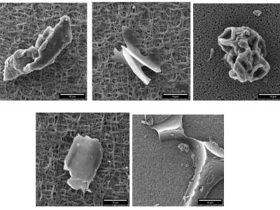 Microplastics in Drinking Water: SEM Investigation