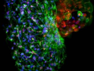Tech Compare: Light Sheet vs. Super Resolution Microscopy for Live-cell Imaging