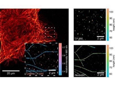 Microscopy Technique Enables Isotropic Super Resolution in Cells