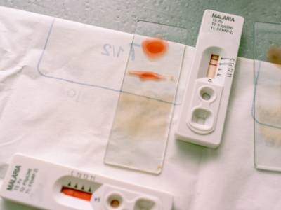Digital PCR Can Help Select Most Effective Rapid Malaria Test