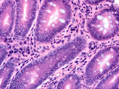 LABTips: Preparing Tissue Samples for Histology