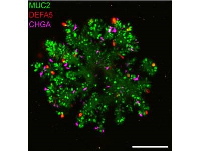 Improved Human Intestinal Organoids Include All Cell Types