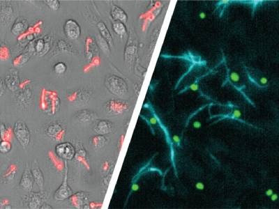 Live-cell Imaging Reveals Escape Mechanisms of Disease-causing Fungus