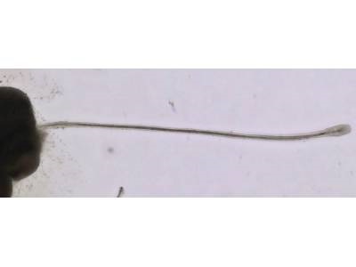 Researchers Grow Fully Mature Hair Follicles in Culture