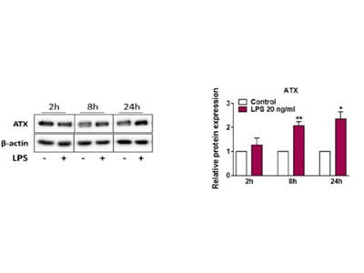 Great Antibody for Detection of Autotaxin Expression via Immunoblotting