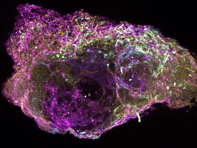 Bone Marrow Organoids Can Aid Development of Blood Cancer Treatments