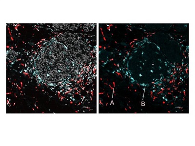 New Method Integrates Spatial Transcriptomics and Proteomics