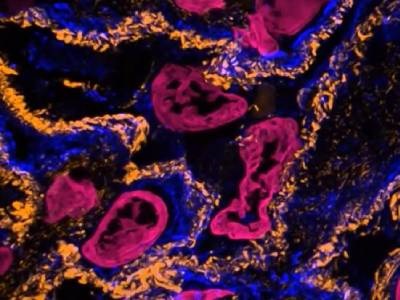Novel Hydrogel Expands Application of Expansion Microscopy