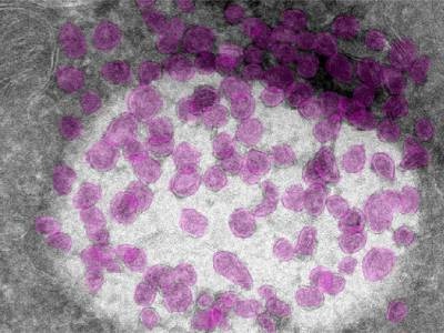 Newly-discovered Organelle Offers Insights into Sense of Smell