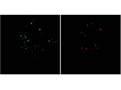 pH-sensitive Fluorescent Probes Yield Insights on Endolysosome Conversion