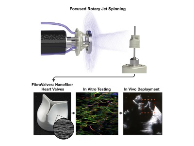 Novel Method Creates Heart Valves in Minutes