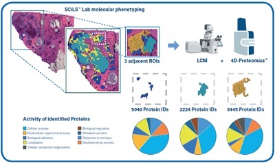 The Challenge of Tumor Heterogeneity in Personalized Medicine