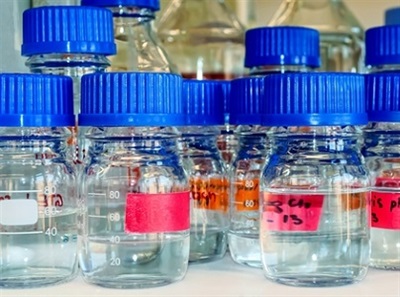 Streamlining the Laboratory Supply Chain