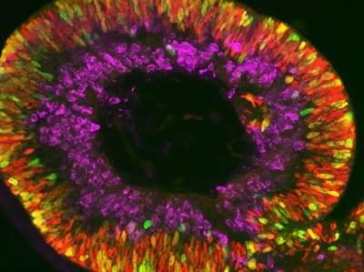A Decade of Transformation: How Organoids are Redefining Drug Development