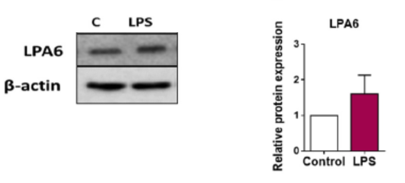 | Labcompare Product Review. Detection of LPA Receptor 6 In Microglia ...