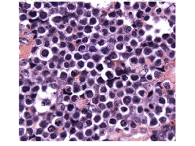 IHC Staining for c-Myc