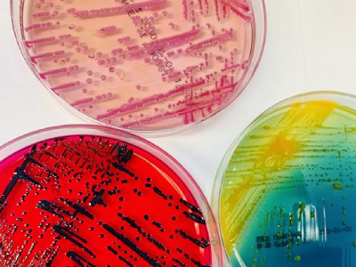 Over 30 Species of Bacteria Identified in a Recent University Hospital Basel Study