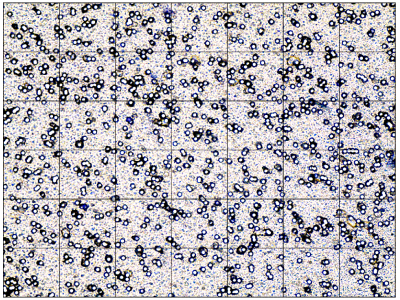 Measuring Cell Mobility Using Transwell Filters