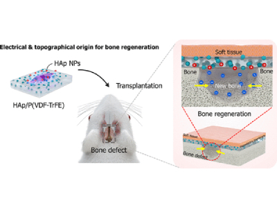 Novel “Bone Bandage” Developed to Increase Bone Regeneration