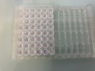 Perfect ELISPOT Assay Plate for Few Samples