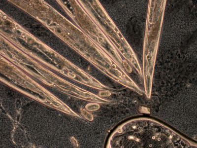 Researchers Develop World's First Endoscopic Device to Visualize Individual Cell Stiffness