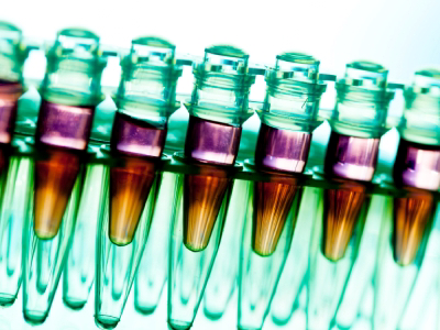 3 Reasons Why RNA Is the Future of Predictive Biomarkers in Oncology
