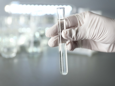 7 FAQs About Ultrapure Water