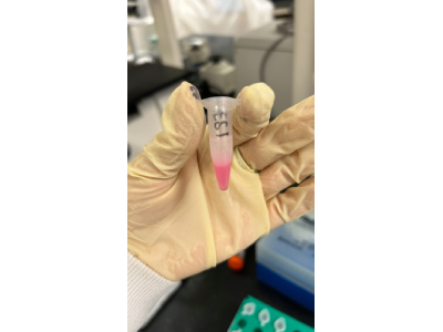 Purification Kit That Outperforms Others