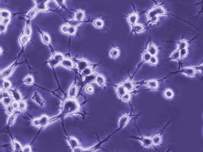 Common Parasite Engineered To Deliver Therapy Proteins Across Blood-Brain Barrier