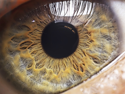 New Gene Therapy Results In 100-Fold Improvement In The Eyesight Of LCA1 Patients