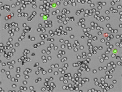 Buyer’s Guide: Automated Cell Counters