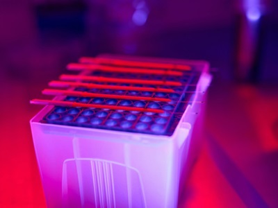  Optimizing Workflows for Autoimmune and Allergy Diagnostics