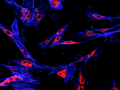 How to Use Gene Therapy to Treat Cancer
