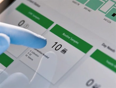 Automation Platform Tackles Manual Bottlenecks in Clinical Lab