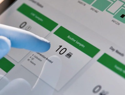 Automation Platform Tackles Manual Bottlenecks in Clinical Lab