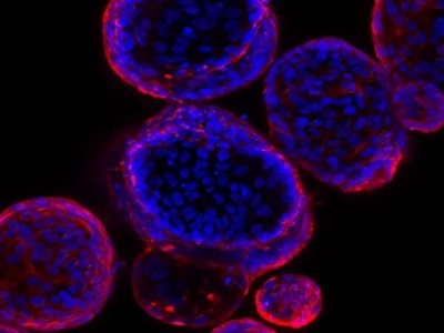 Innovations in Multimodal Image Analysis Help Improve Biopharma Productivity