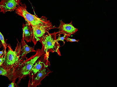 Improved Raman Microscope Enhances Imaging Quality of Cryofixed Samples