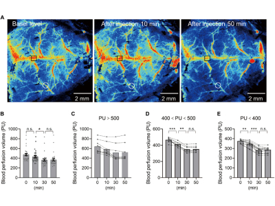 Microplastics Discovered in Mice Brain Tissue Within Hours of Consumption