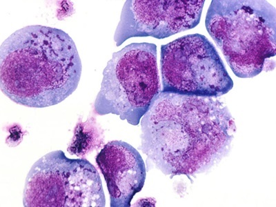 Microscopy Combo Method Reveals Herpes Secrets