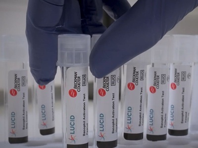 New Basophil Activation Test Expedites Allergy Research