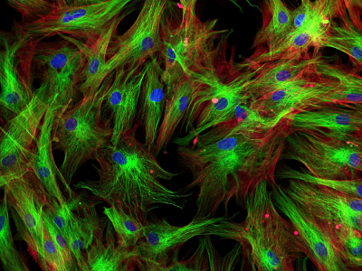 Probe Molecules With Anchoring Units Allow Whole Organ Enzyme Activity Imaging