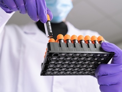 Tubes Ideal for Labs Needing Sterile Sample Storage Solutions