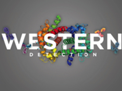 Western Detection: A Guide to Better Blots