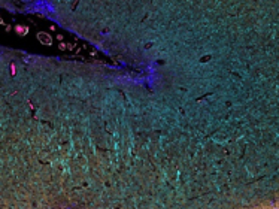 Advanced Spatial Profiling of the Brain Tumor Microenvironment Using Multiplex Immunochemistry